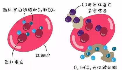 警惕洗澡季隱形殺手 一氧化碳中毒康復后，當心遲發性腦病